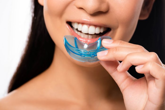 Sports Mouthguards 101: How They Protect Your Teeth and Jaw
